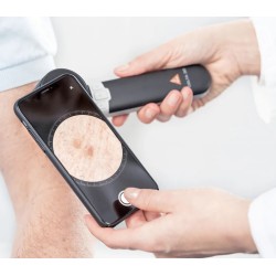 HEINE DELTA 30 Dermatoscope DERManager