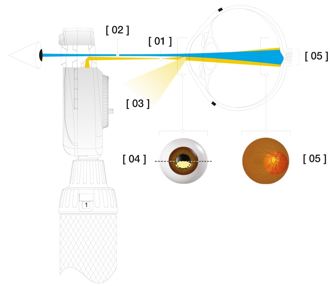 The HEINE Aspherical Optical System The Aspherical Optical System