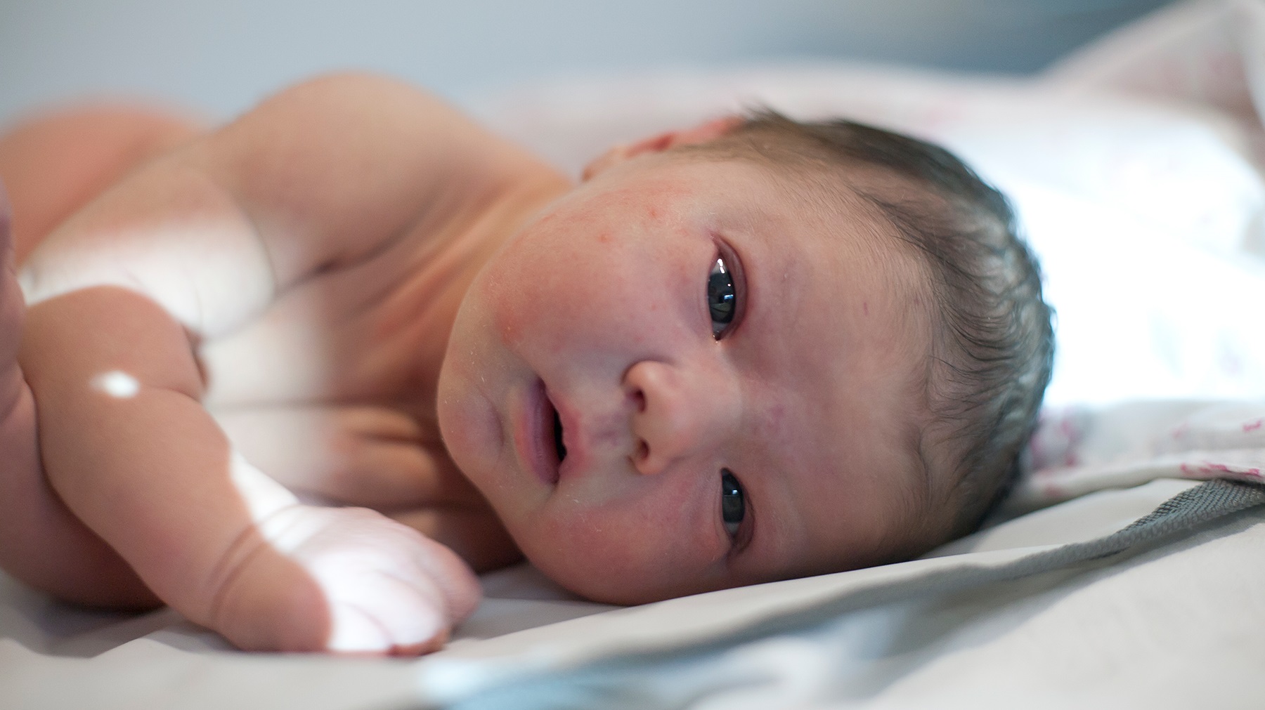 Brückner Test Baby Brückner Test Baby