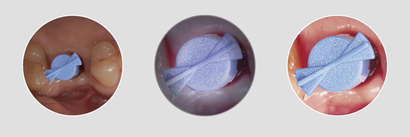 HEINE headlights competitor product