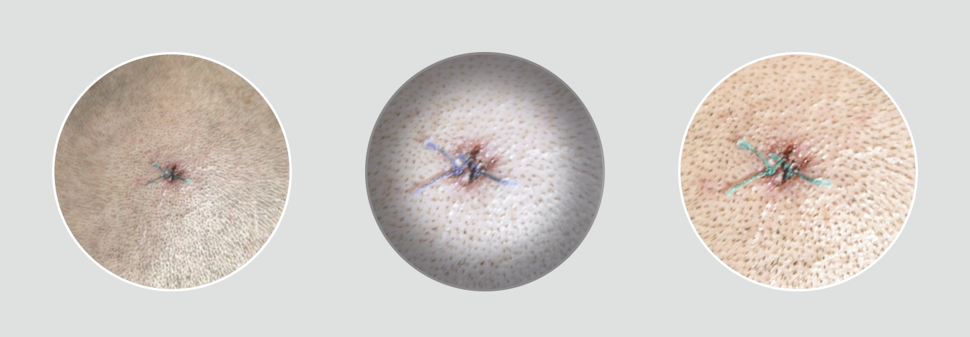 HEINE headlights light quality