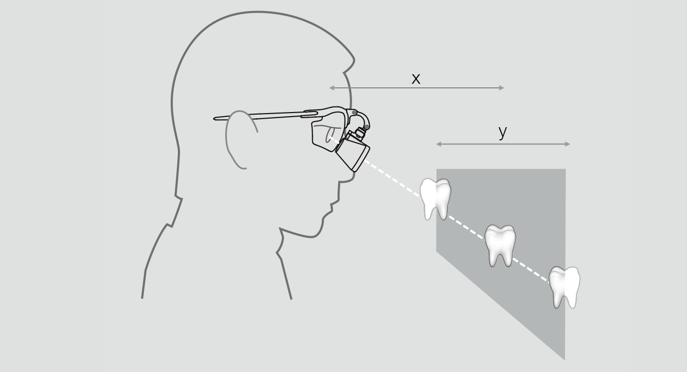 HEINE Binocular loupes select working distance