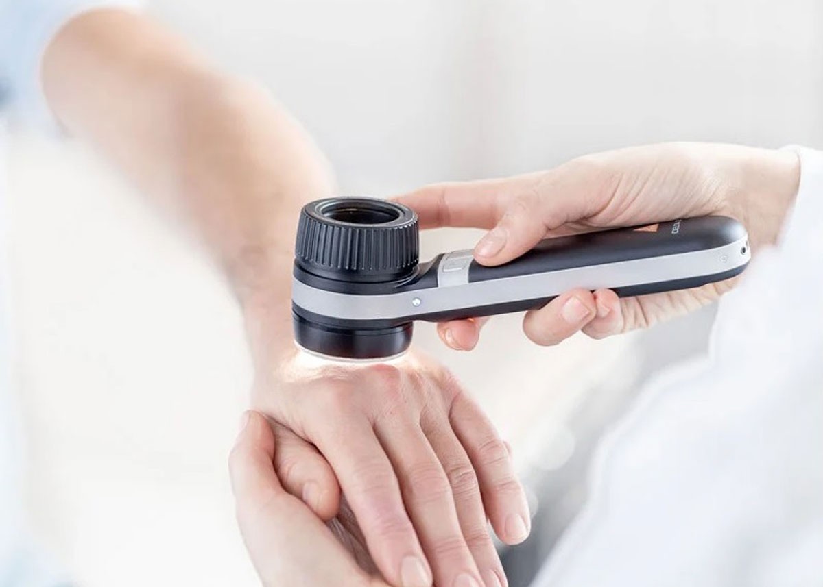 HEINE DELTA 30 Dermatoscope: A New Benchmark in Dermatological Diagnostics HEINE DELTA 30 Dermatoscope: A New Benchmark in Dermatological Diagnostics